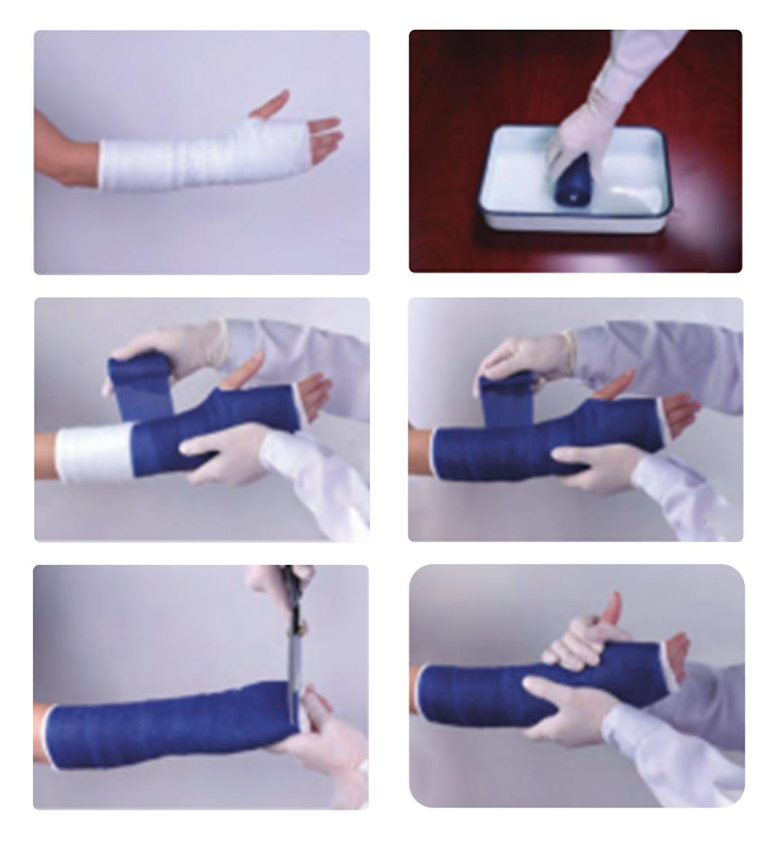 Steps for using the Orthopaedic Casting Tape
