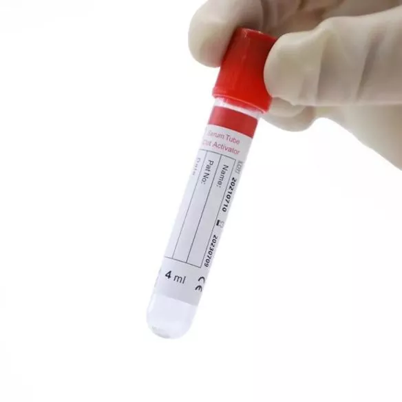 Serum Clot Activator Tube